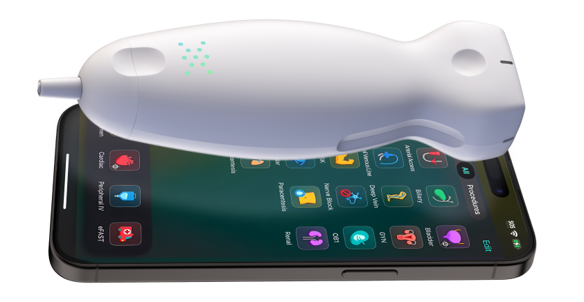 Exo handheld ultrasound probe resting on a phone displaying its application
